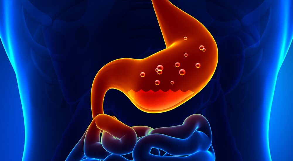 gastritis