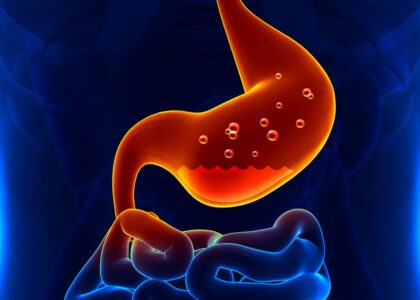 gastritis